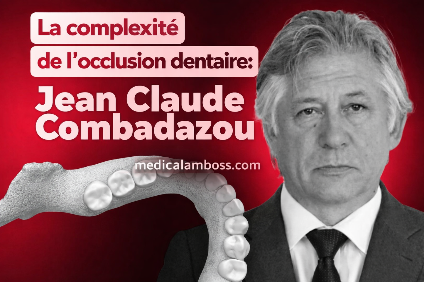 OHI-S La complexité de l’occlusion dentaire Diagnostic et traitement