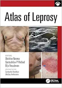 Atlas of Leprosy (Original PDF from Publisher+Videos)