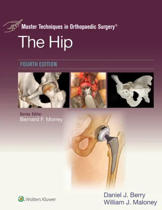 Master Techniques in Orthopaedic Surgery: The Hip, 4th Edition (EPUB)
