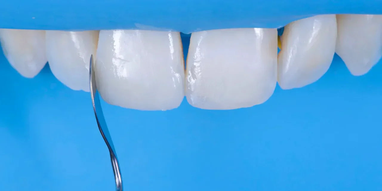 OHI-S Aesthetic Dentistry Congress in Milan Difficult cases in esthetic dentistry