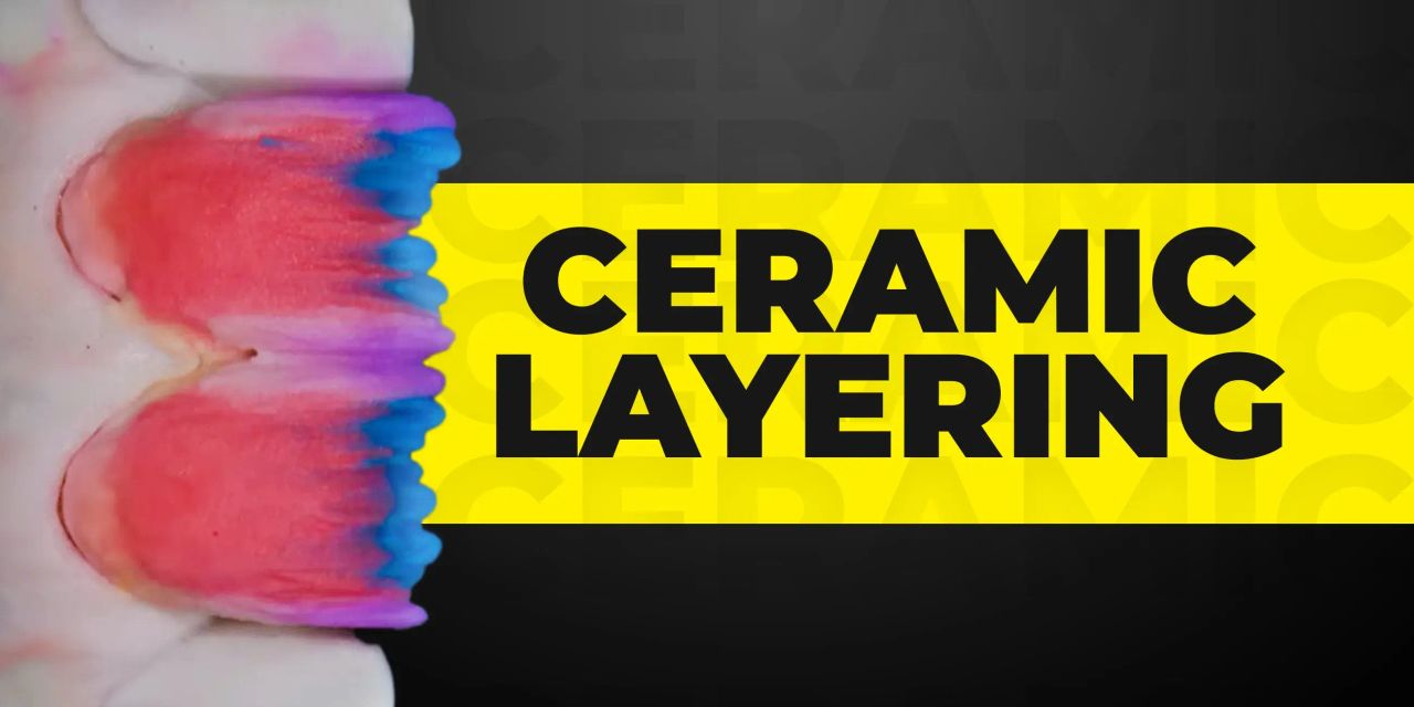 OHI-S Ceramic layering protocols of the world’s leading schools