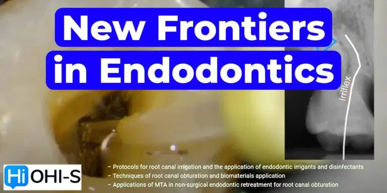 OHI-S New Frontiers in Endodontics Guide to Predictable Practice