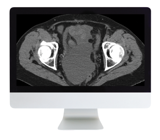 Radiologic Reasoning: A Rapid-Fire Multispecialty Review 2018 (ARRS VIDEOS)