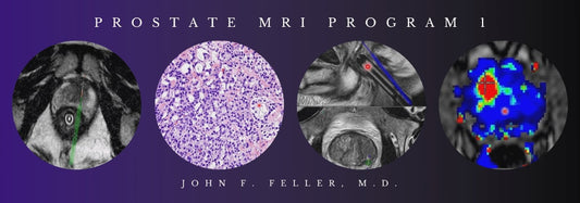 2021 Prostate MRI (Program 1) – John F. Feller, M.D(vedio)