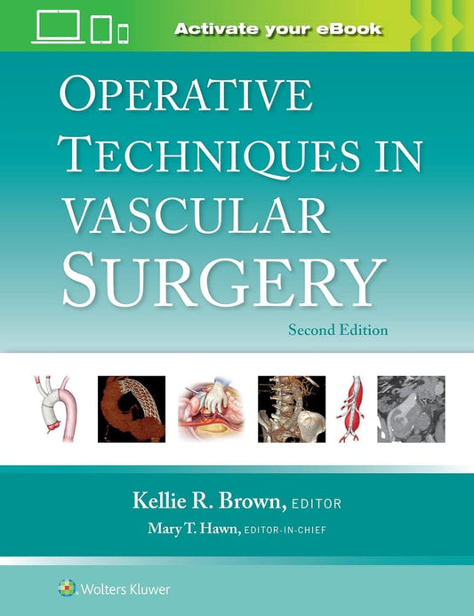 Operative Techniques in Vascular Surgery, 2nd Edition pdf