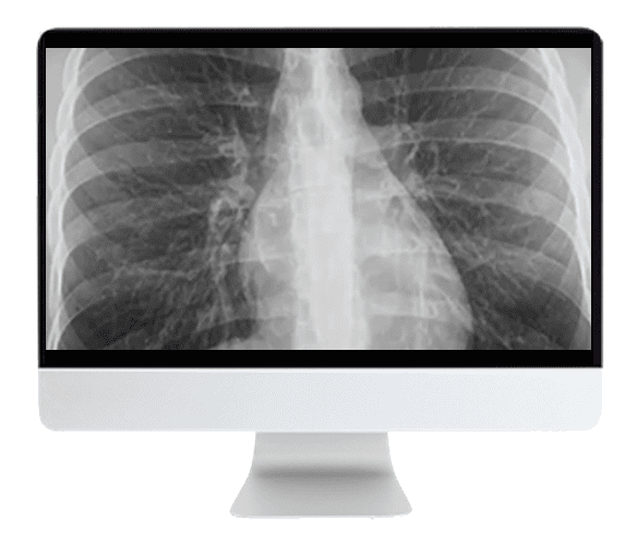 ARRS Cranial Nerve Imaging: From the Least to the Last 2022 ( Videos )