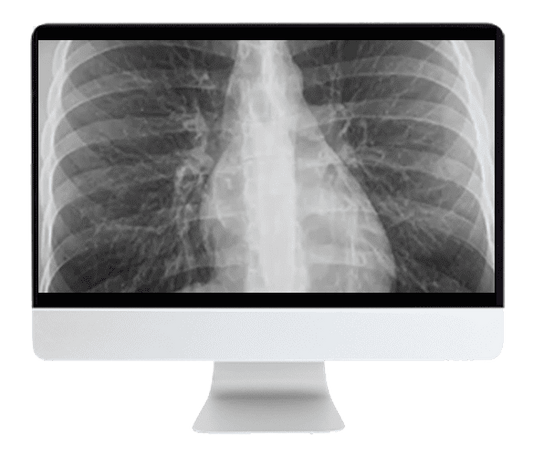 ARRS Liver, Pancreatic, and Biliary Tumors 2022 (Videos + CME Questions)
