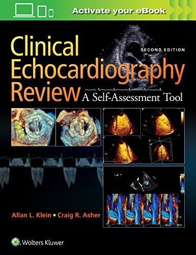 Clinical Echocardiography Review: A Self-Assessment Tool, Second Edition pdf
