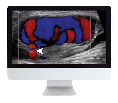 Clinical Ultrasound Review 2017 (ARRS VIDEOS)