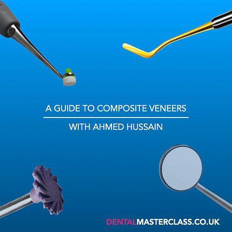 Composite Veneer  By: Dr Ahmed Hussain