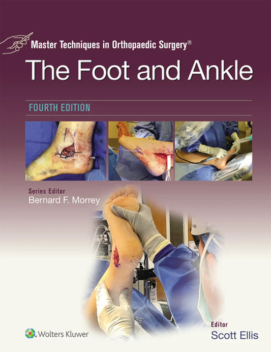 Master Techniques in Orthopaedic Surgery: The Foot and Ankle, 4th Edition ( converted pdf and epud )