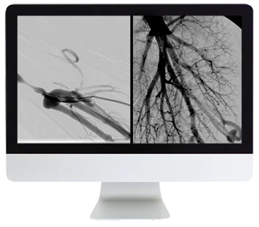ARRS Case Review of Vascular and Interventional Radiology 2023 (Videos)