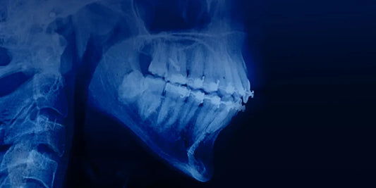OHI-S Orthodontic treatment in patients with periodontal and alveolar bone pathology