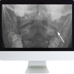 Neuroradiology Review for the Practicing Radiologist 2018 (ARRS VIDEOS)