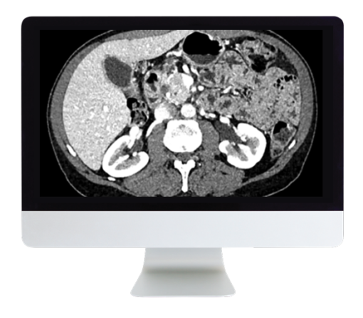 ARRS Gastrointestinal Imaging Online Course 2019