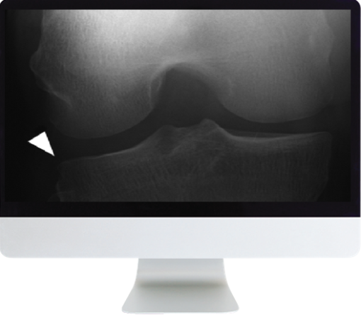 Musculoskeletal Imaging for the Practicing Radiologist 2018 (ARRS VIDEOS)