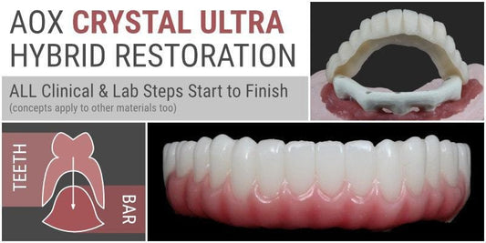 Ripeglobal A to Z of Porcelain Laminate Veneers (Copy)
